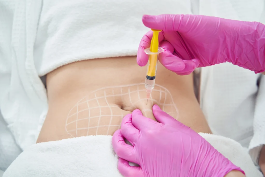 Lipo Dissolve in Miami Lakes FL