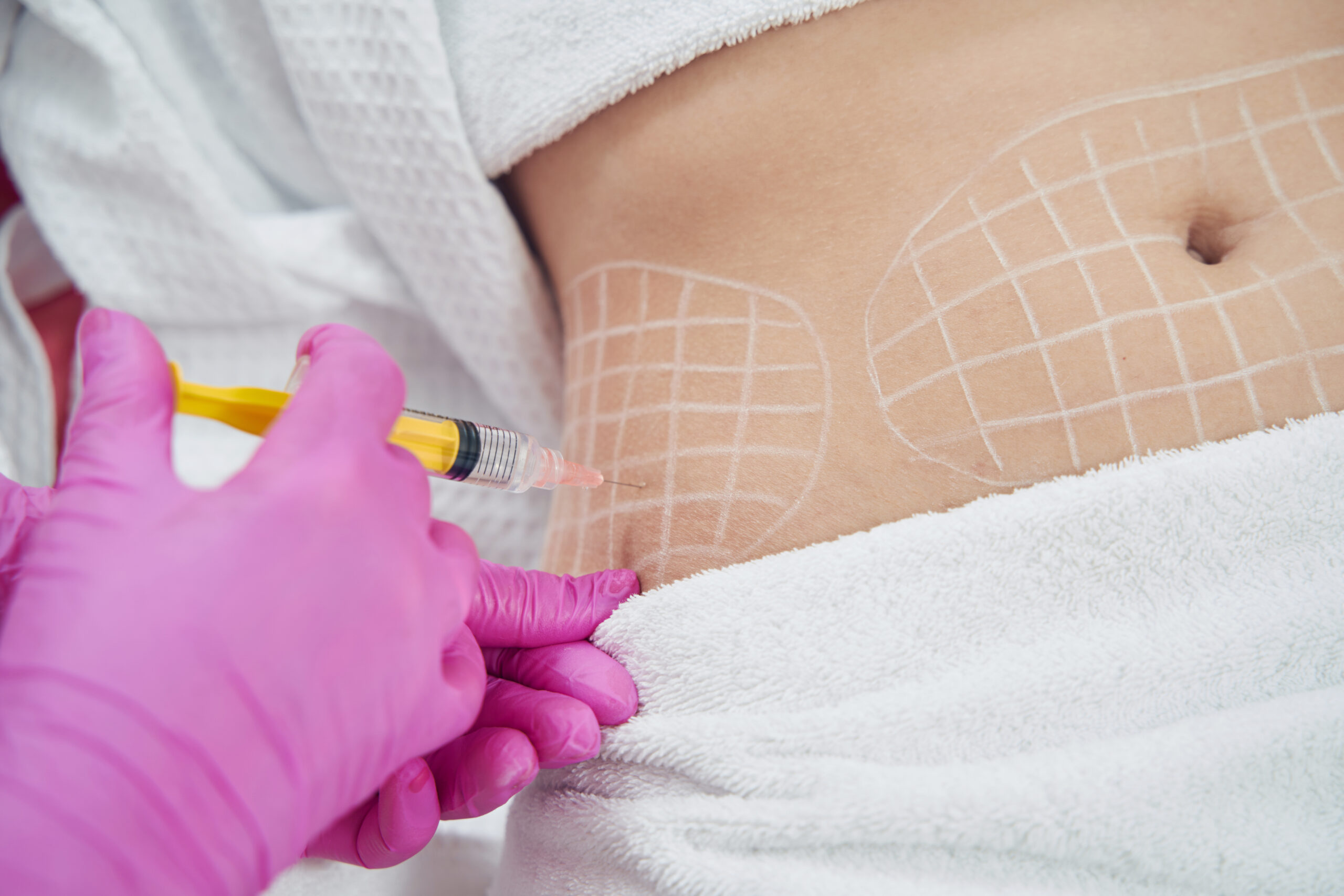 Lipo-Dissolve by Hydra Prime IV and Wellness in Miami Lakes, FL