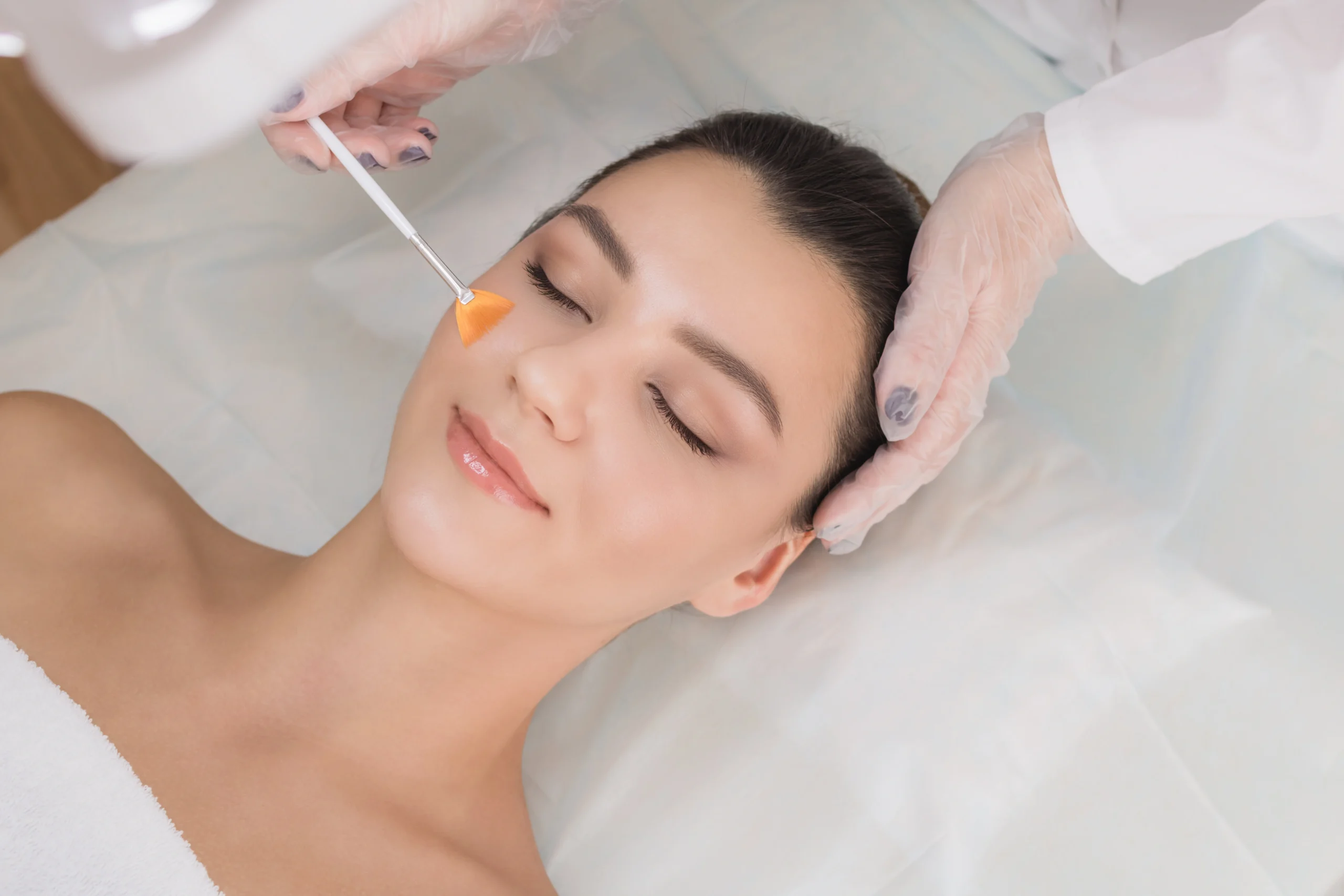 VI Peel application on face | Hydra Prime IV and Wellness | Miami Lakes, FL